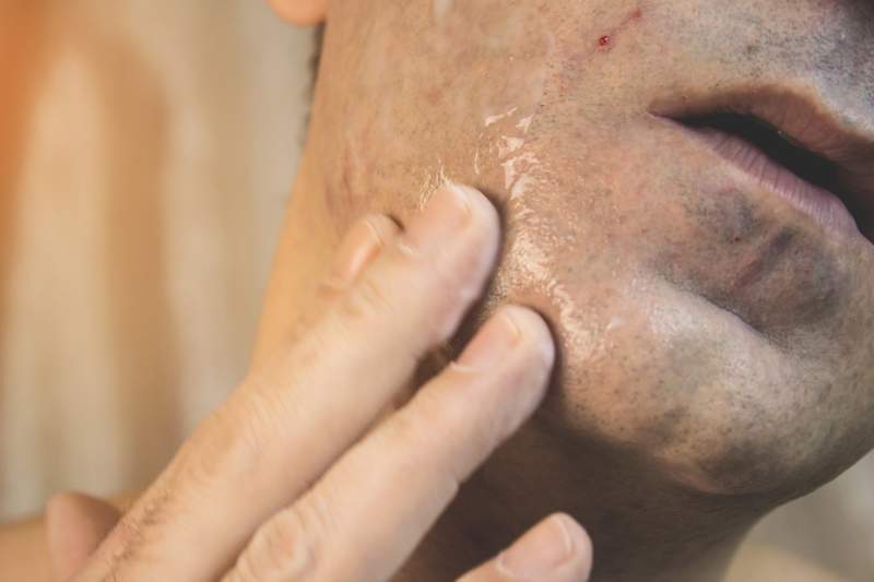 Podrażniona skóra po goleniu